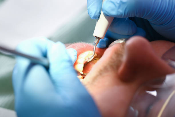 Best Emergency Gum Treatment in Columbia City, OR