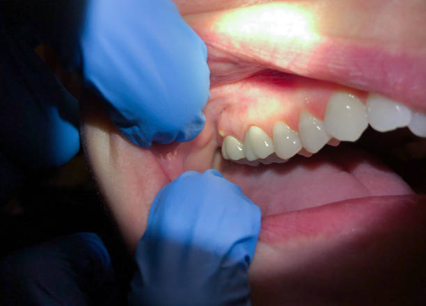 Best Pediatric Emergency Dentist in Columbia City, OR