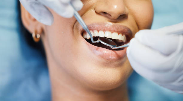 Best Emergency Root Canal Treatment in Columbia City, OR